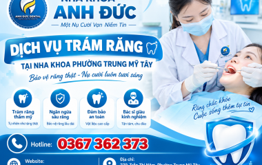 Dịch vụ trám răng tại nha khoa phường Trung Mỹ Tây