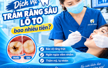 Dịch vụ trám răng sâu lỗ to bao nhiêu tiền?