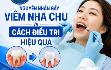 Nguyên nhân gây viêm nha chu và cách điều trị hiệu quả