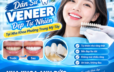 Dán sứ Veneer đẹp tự nhiên tại nha khoa phường Trung Mỹ Tây