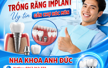 Địa chỉ trồng răng implant uy tín gần chợ Hóc Môn