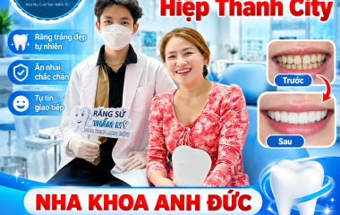 Bọc răng sứ tại nha khoa gần khu dân cư Hiệp Thành City