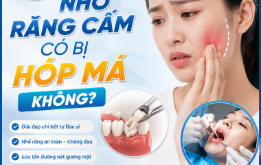 Nhổ răng cắm có bị hóp má không?
