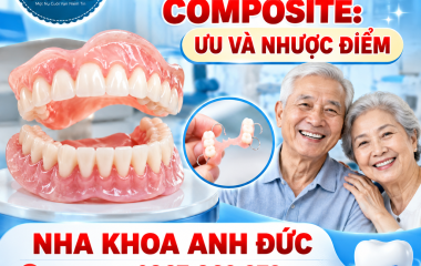 Tìm hiểu về răng tháo lắp composite: Ưu và nhược điểm