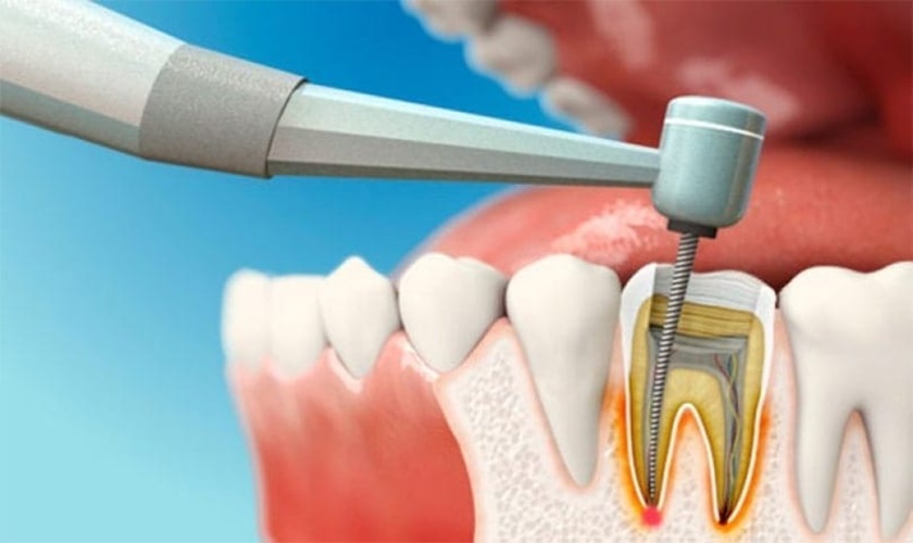 Phòng khám nha khoa gần đường Lê Văn Khương