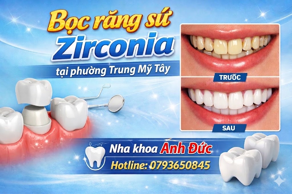 Bọc răng sứ Zirconia tại Nha khoa phường Trung Mỹ Tây