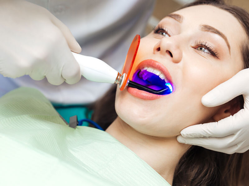 Dịch vụ tẩy trắng răng thẩm mỹ quận 12