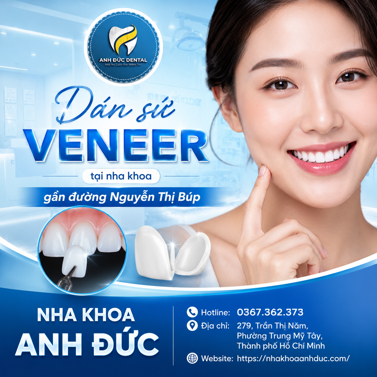 Dán sứ Veneer tại nha khoa gần đường Nguyễn Thị Búp