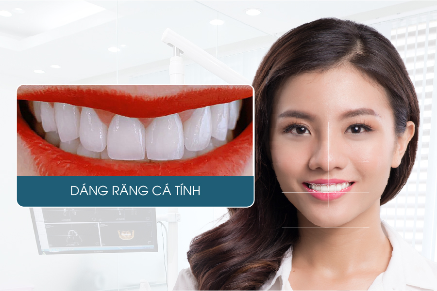 Các dáng răng sứ được yêu thích hiện nay