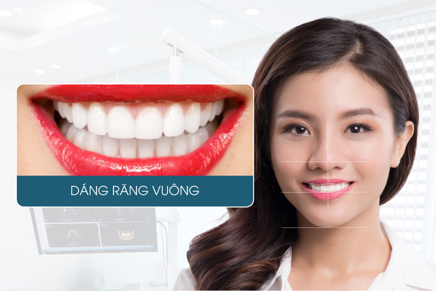 Các dáng răng sứ được yêu thích hiện nay