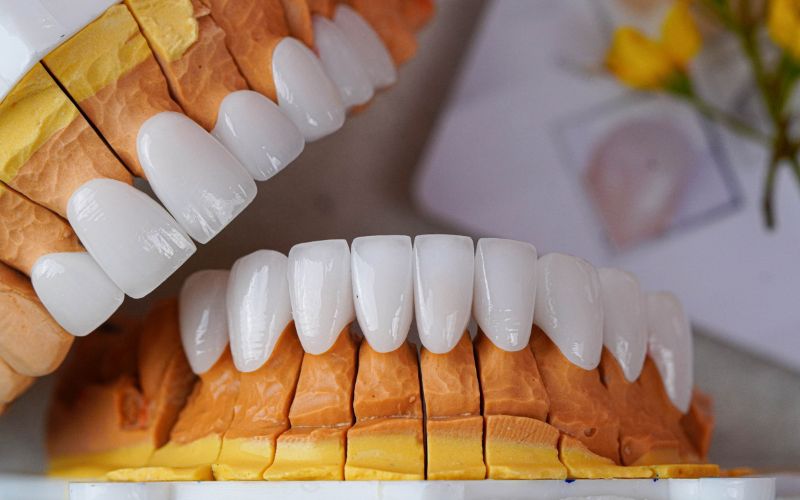 Bọc răng sứ Zirconia tại Nha khoa phường Trung Mỹ Tây