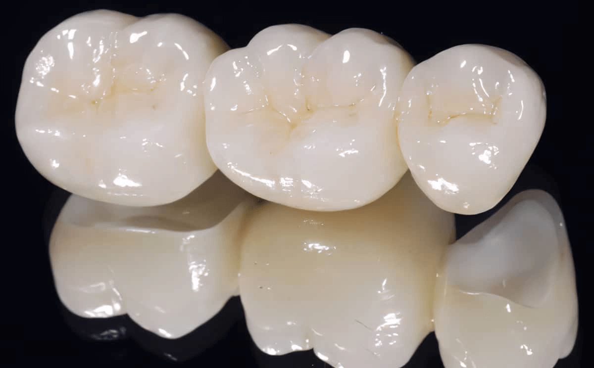 Làm răng sứ ở đâu tốt tại quận 12? 