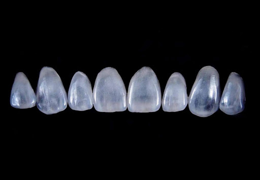 Hình ảnh mặt dán sứ Veneer Emax