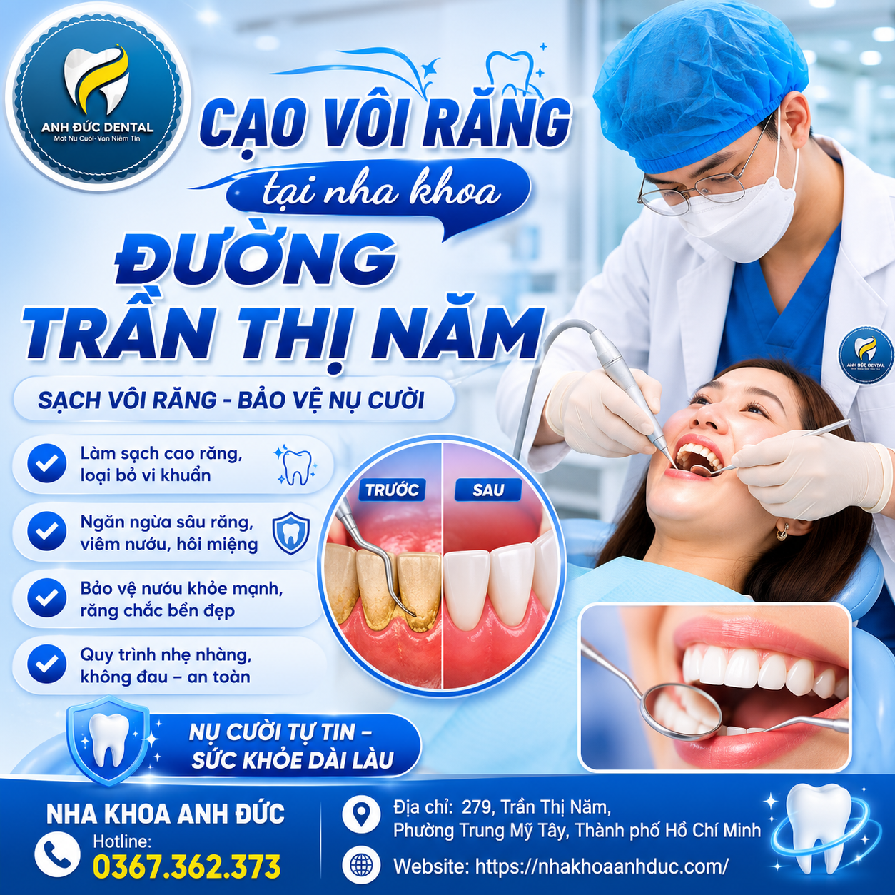 Cạo vôi răng tại nha khoa đường Trần Thị Năm