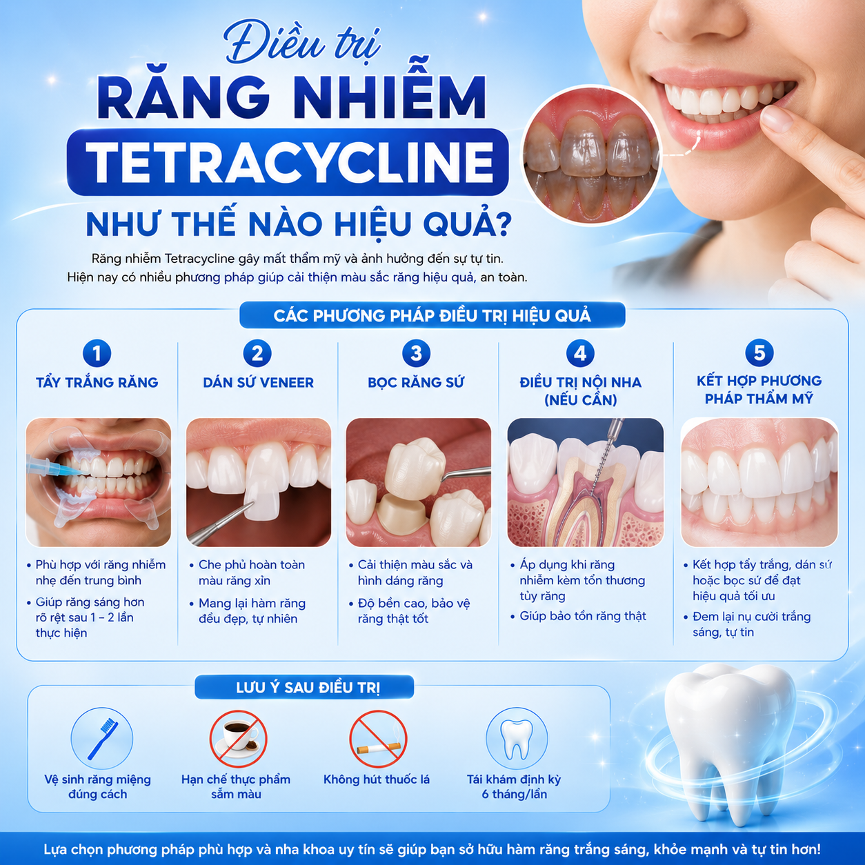 Điều trị răng nhiễm Tetracycline như thế nào hiệu quả?