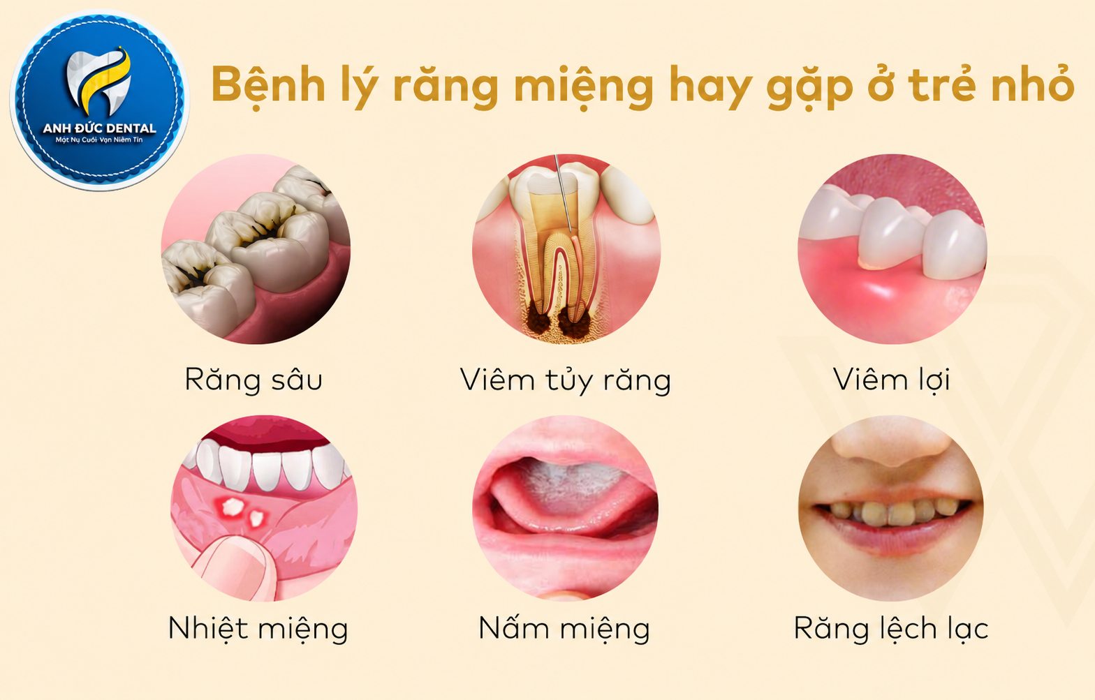 Những triệu chứng răng miệng mà trẻ em thường gặp