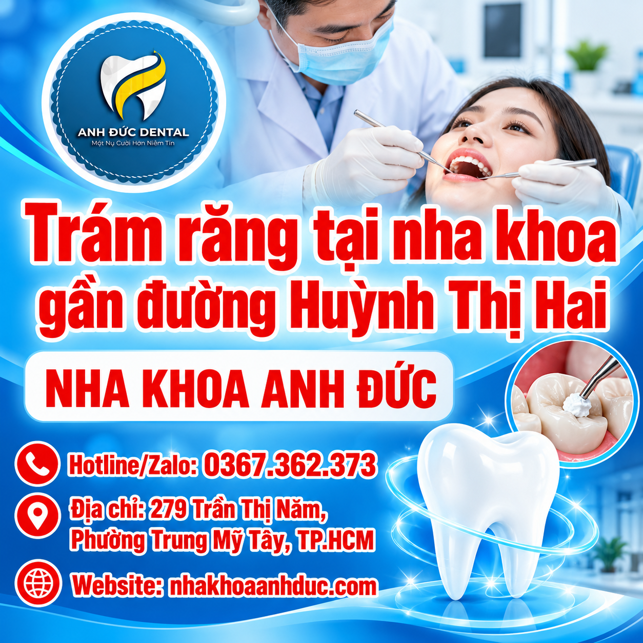 Trám răng tại nha khoa gần đường Huỳnh Thị Hai