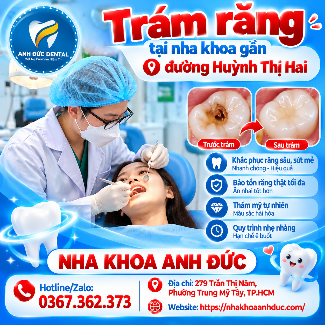 Trám răng tại nha khoa gần đường Huỳnh Thị Hai