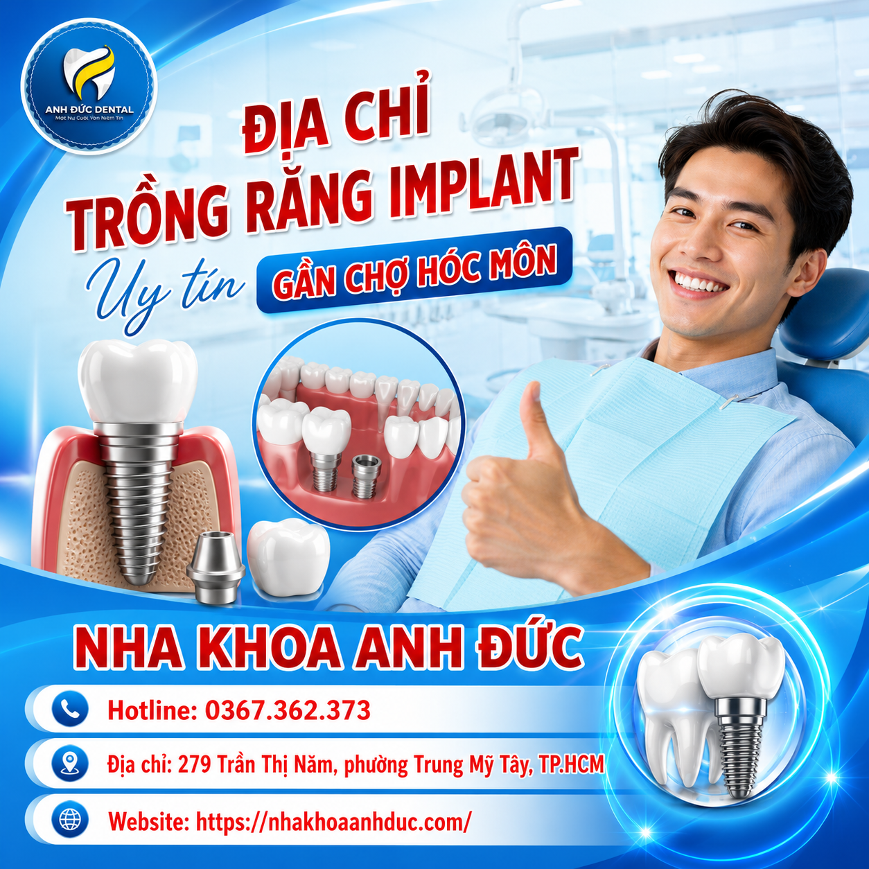 Địa chỉ trồng răng implant uy tín gần chợ Hóc Môn
