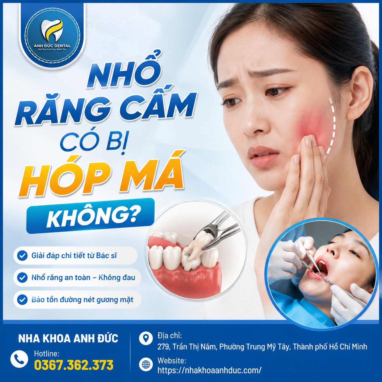 Nhổ răng cấm có bị hóp má không?
