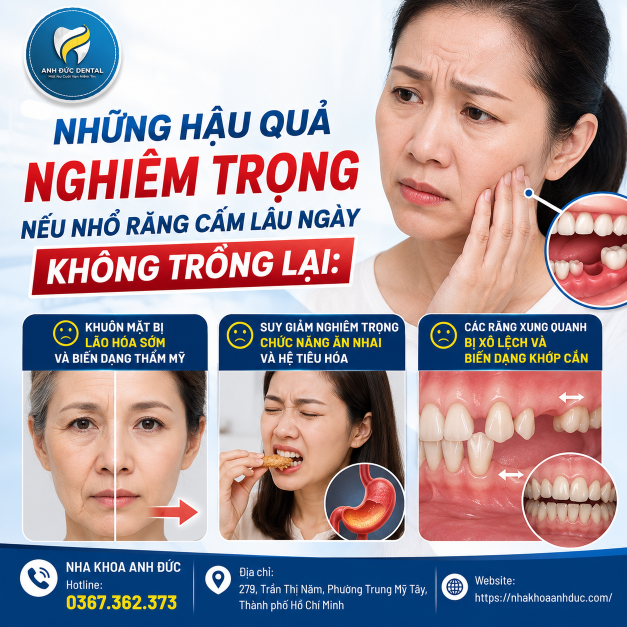 Nhổ răng cấm có bị hóp má không?