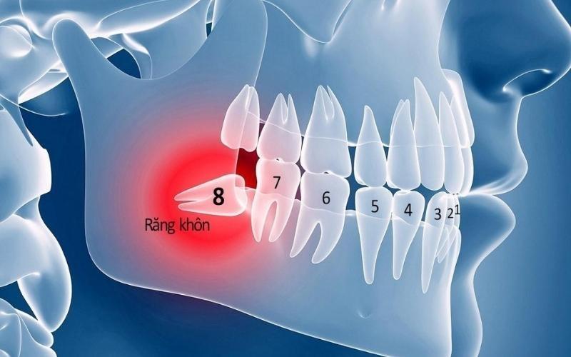 Địa chỉ nhổ răng khôn gần đường Nguyễn Ảnh Thủ
