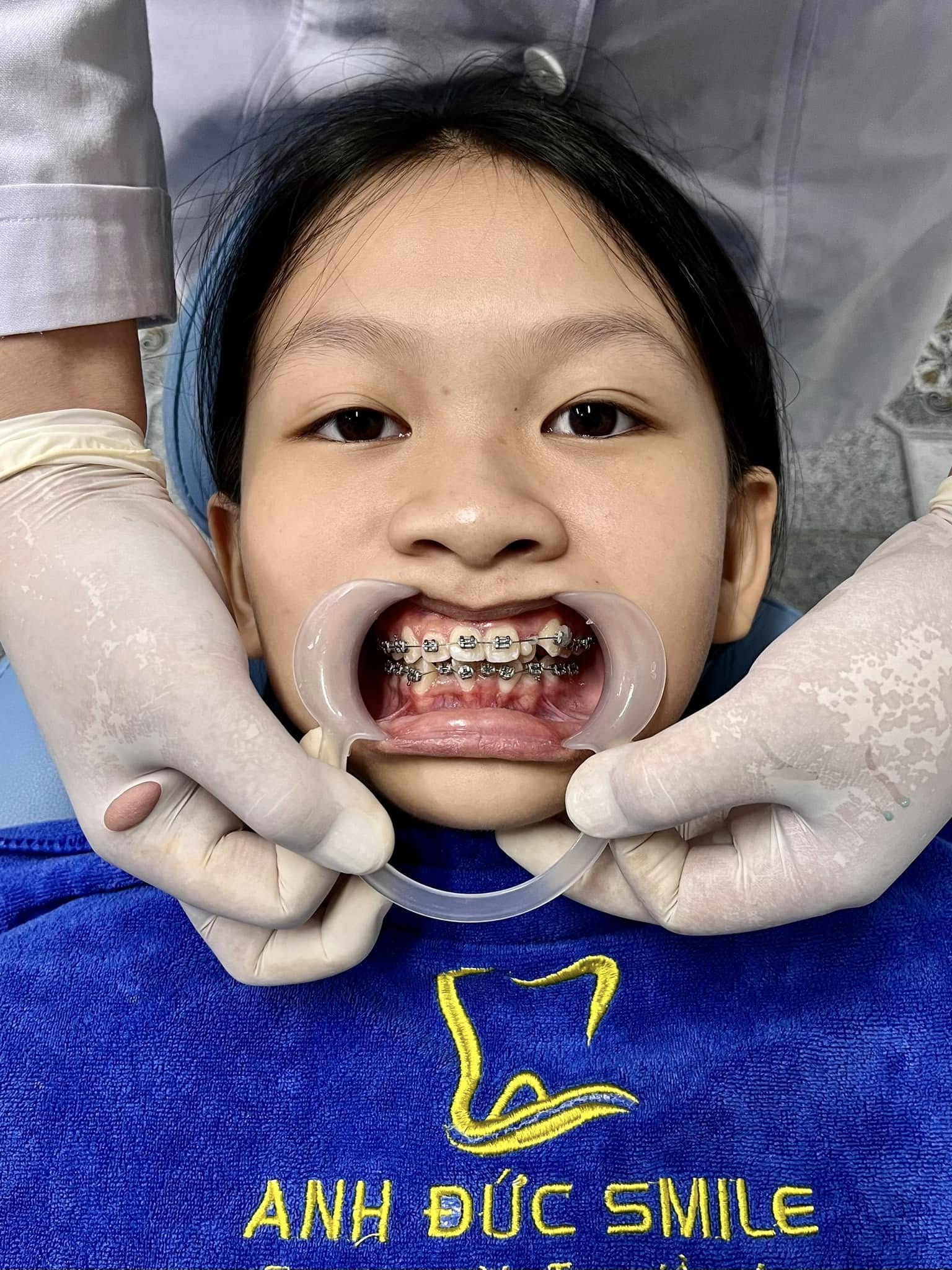 Giới thiệu về Nha khoa Anh Đức