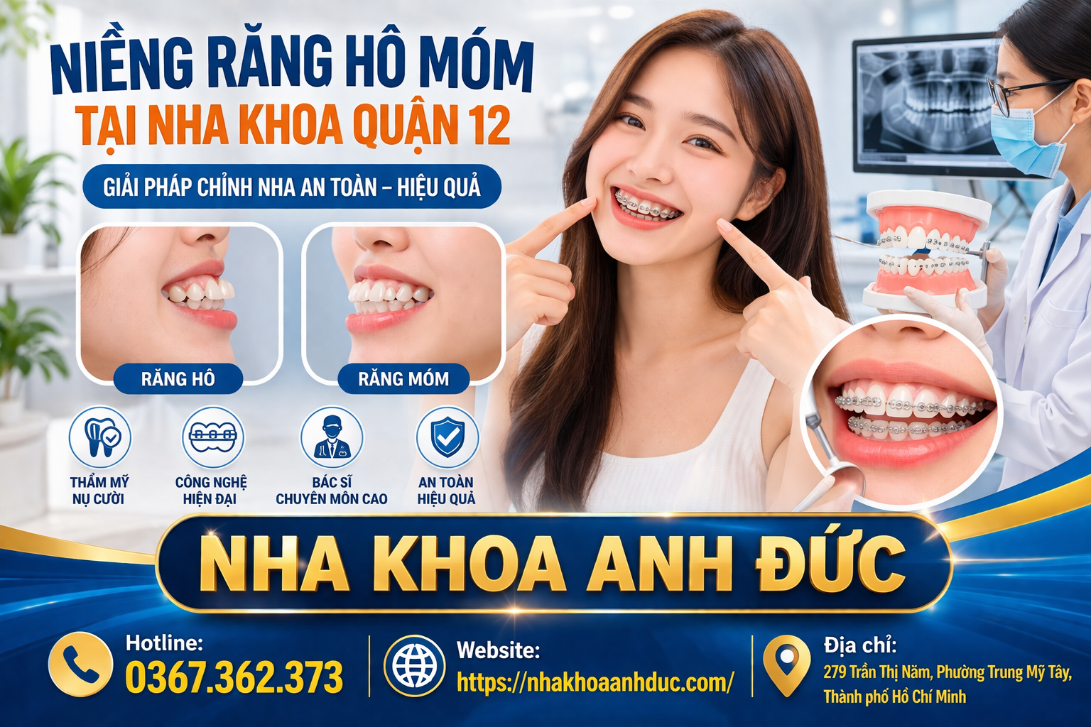 Niềng răng hô móm tại Nha khoa quận 12