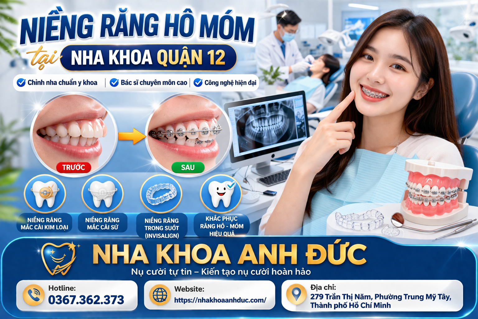 Niềng răng hô móm tại Nha khoa quận 12