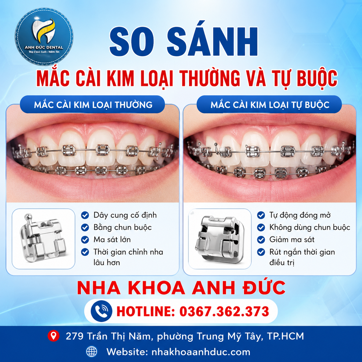 So sánh mắc cài kim loại thường và tự buộc