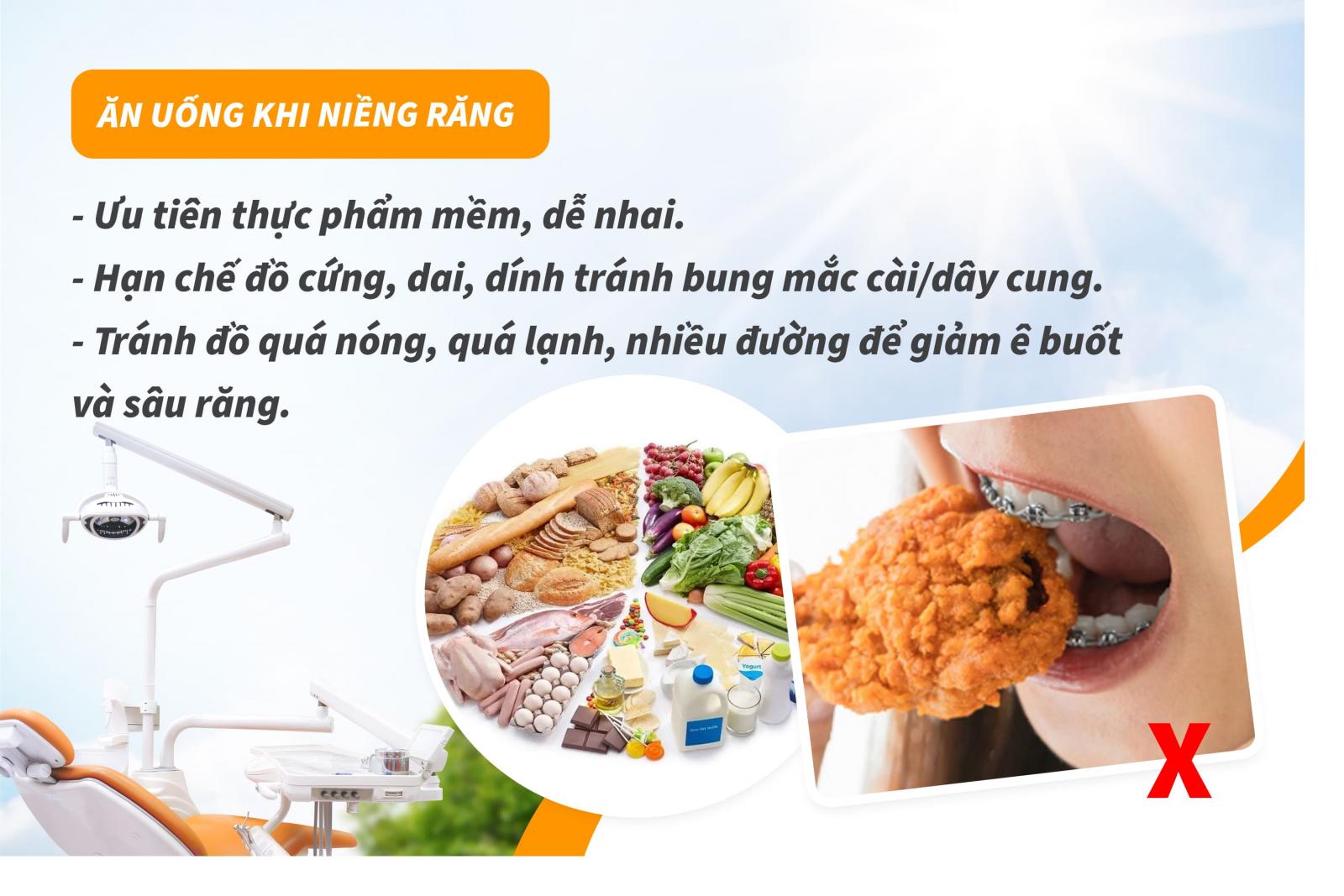 Những lưu ý quan trọng sau khi niềng răng
