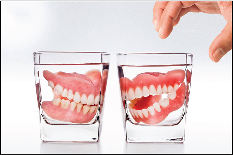 Những lưu ý quan trọng để giữ hàm giả tháo lắp luôn bền đẹp