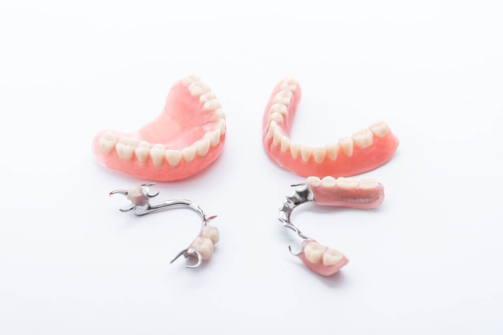 Phục hình tháo lắp tại Nha khoa quận 12