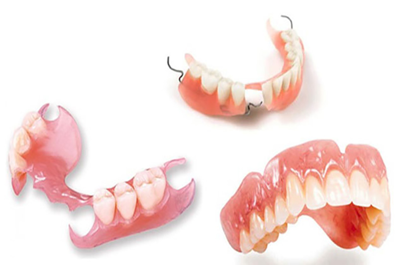 Ưu điểm của hàn tháo lắp composite