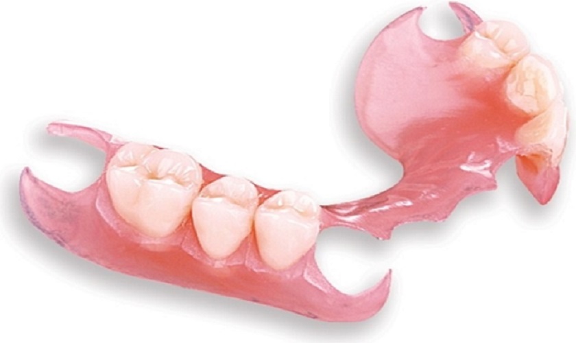 Phục hình tháo lắp tại Nha khoa quận 12