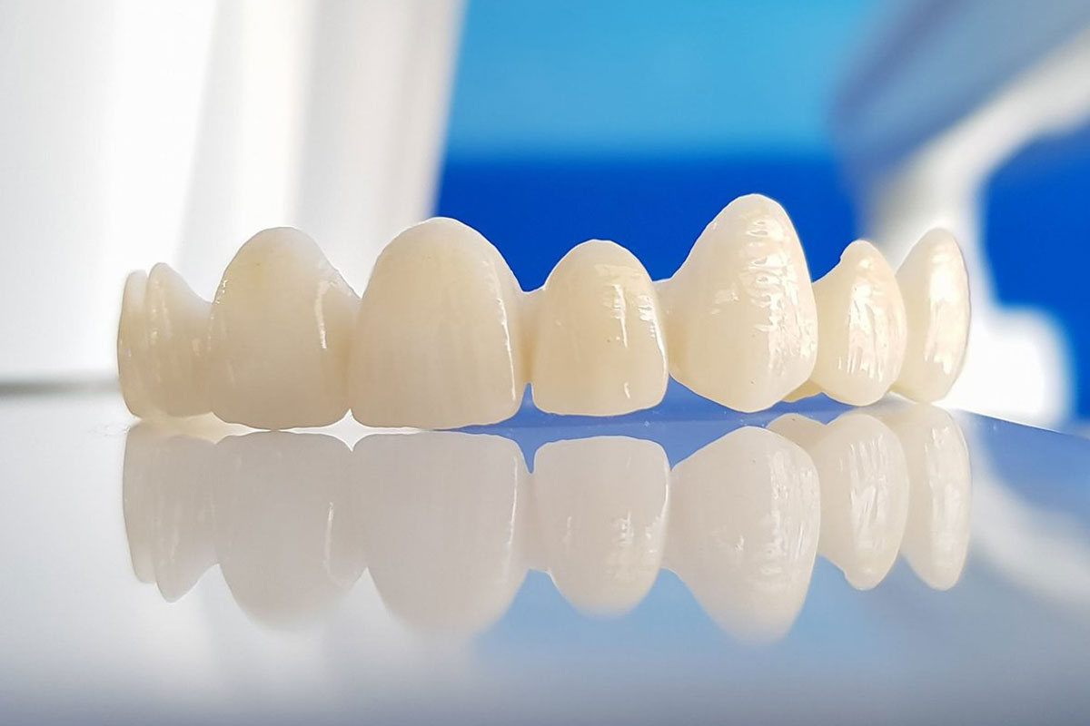 Hình ảnh răng sứ zirconia