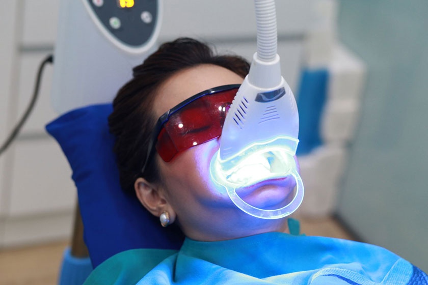 Dịch vụ tẩy trắng răng thẩm mỹ quận 12