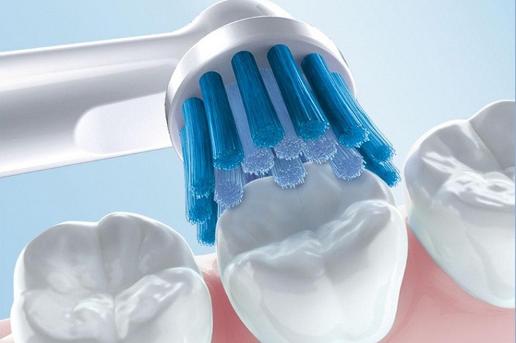 Lời khuyên từ Nha khoa Anh Đức giúp giữ răng sứ Zirconia bền đẹp