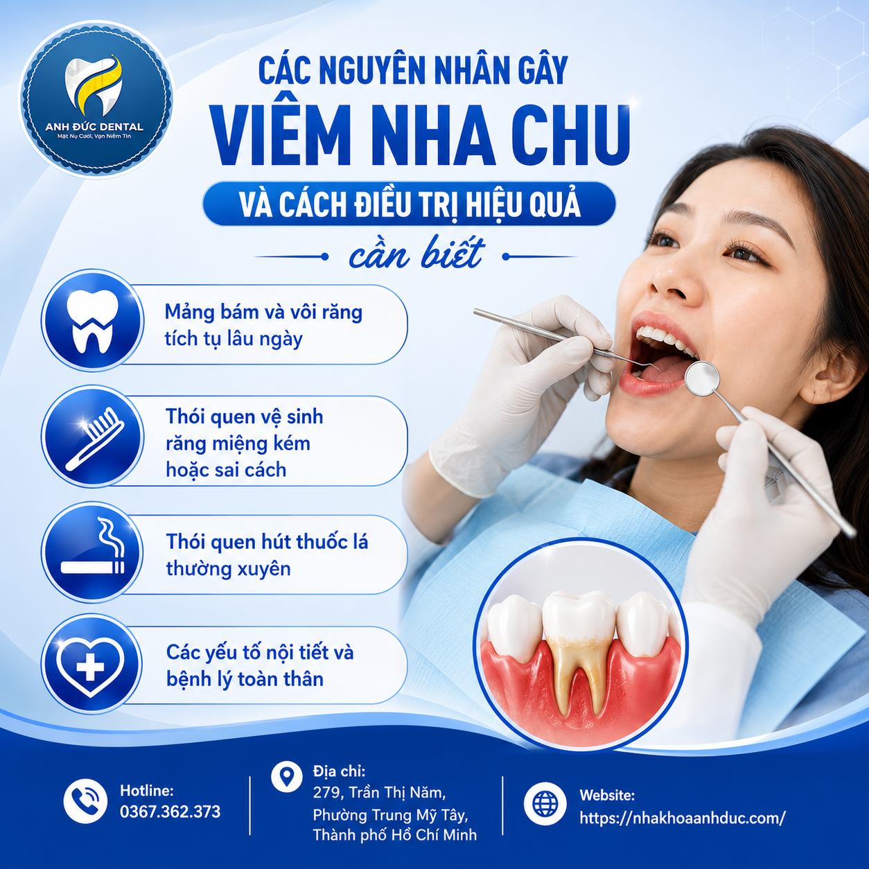 Các nguyên nhân gây viêm nha chu và cách điều trị hiệu quả cần biết