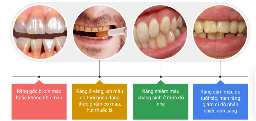 Dịch vụ tẩy trắng răng thẩm mỹ quận 12
