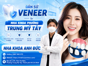 Dán sứ Veneer tại nha khoa phường Trung Mỹ Tây