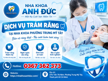 Dịch vụ trám răng tại nha khoa phường Trung Mỹ Tây