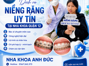 Dịch vụ niềng răng uy tín tại nha khoa quận 12