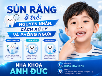 Sún răng ở trẻ: Nguyên nhân, cách xử lý và phòng ngừa