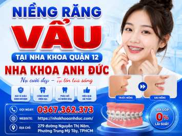 Niềng răng vẩu tại nha khoa quận 12