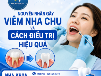 Nguyên nhân gây viêm nha chu và cách điều trị hiệu quả