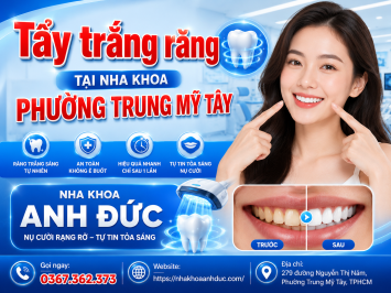 Tẩy trắng răng  tại nha khoa phường Trung Mỹ Tây