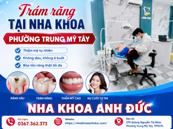 Trám răng tại nha khoa phường Trung Mỹ Tây