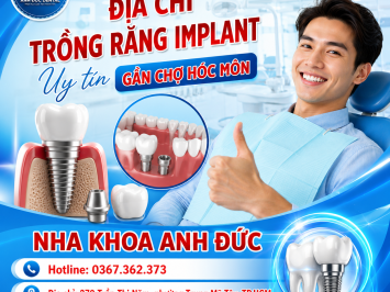 Địa chỉ trồng răng implant uy tín gần chợ Hóc Môn