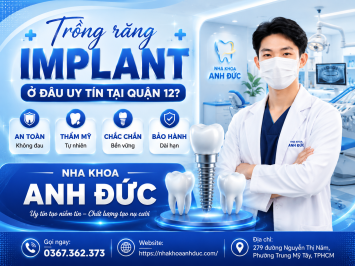 Trồng răng implant ở đâu uy tín tại quận 12?
